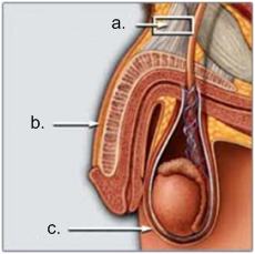 Penisförstoring - vad som sker vid operation a.) visar de ligament som lossas vid en penisförlängning b.) penis c.) pungen